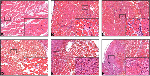法医病理学：利用TissueFAXS系统精准识别大鼠挫伤性骨骼肌再生过程中性粒细胞