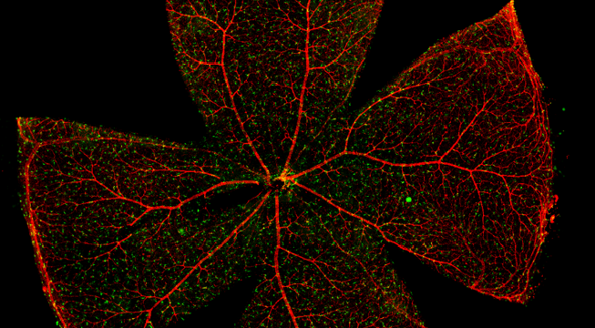 TissueGnostics带您解读视网膜组织形态学特征及多种结构定量