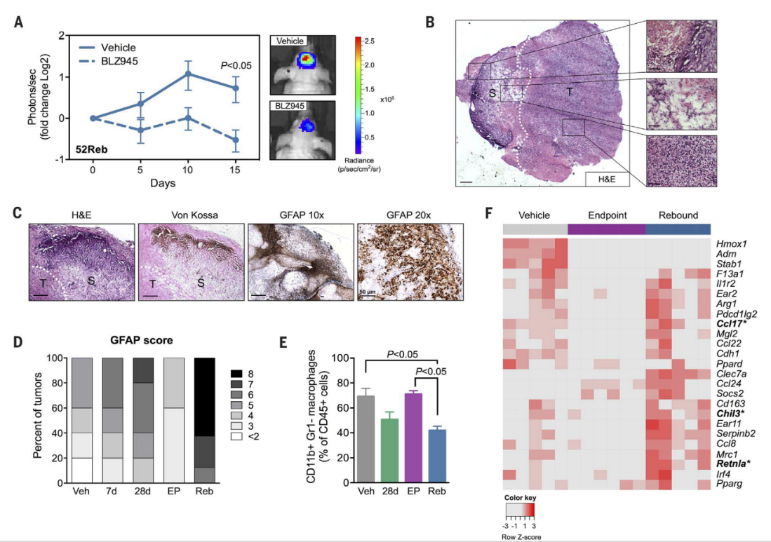 Science |肿瘤微环境是神经胶质母细胞瘤获得CSF-1受体阻断剂抵抗的基础